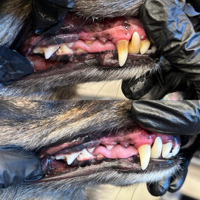 Deep teeth cleaning
